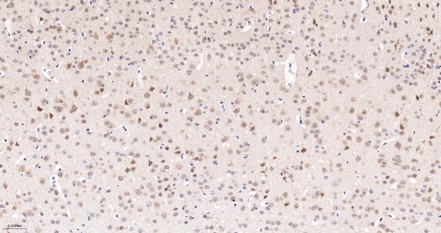 Jun激活区域-连接蛋白1重组兔单抗