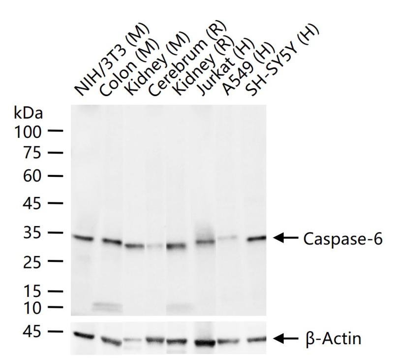 Caspase-6重组兔单抗