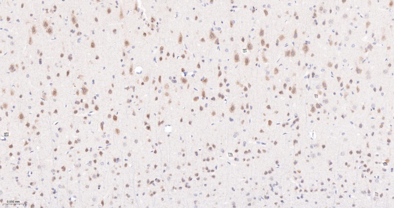 Jun激活区域-连接蛋白1重组兔单抗