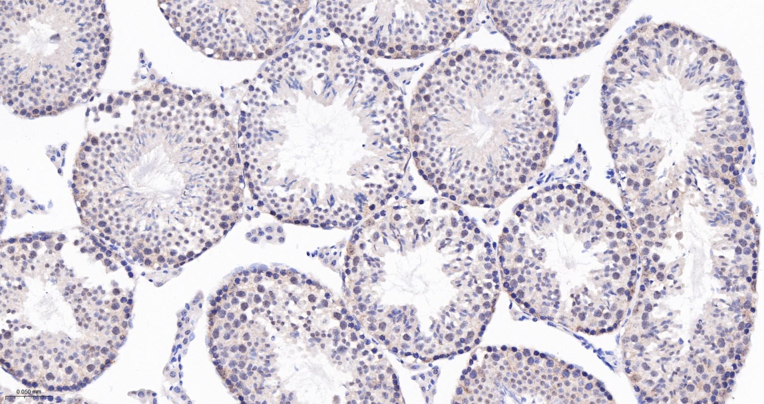 Jun激活区域-连接蛋白1重组兔单抗