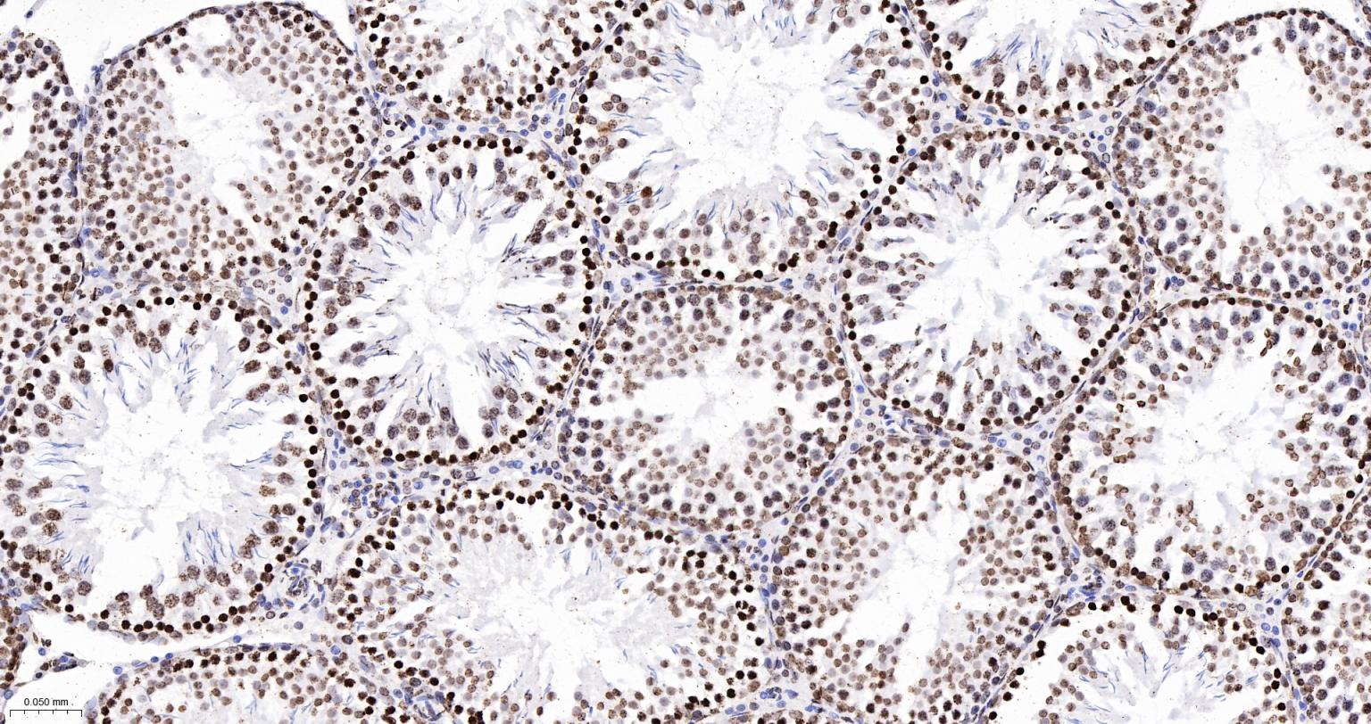 组蛋白H4重组兔单抗