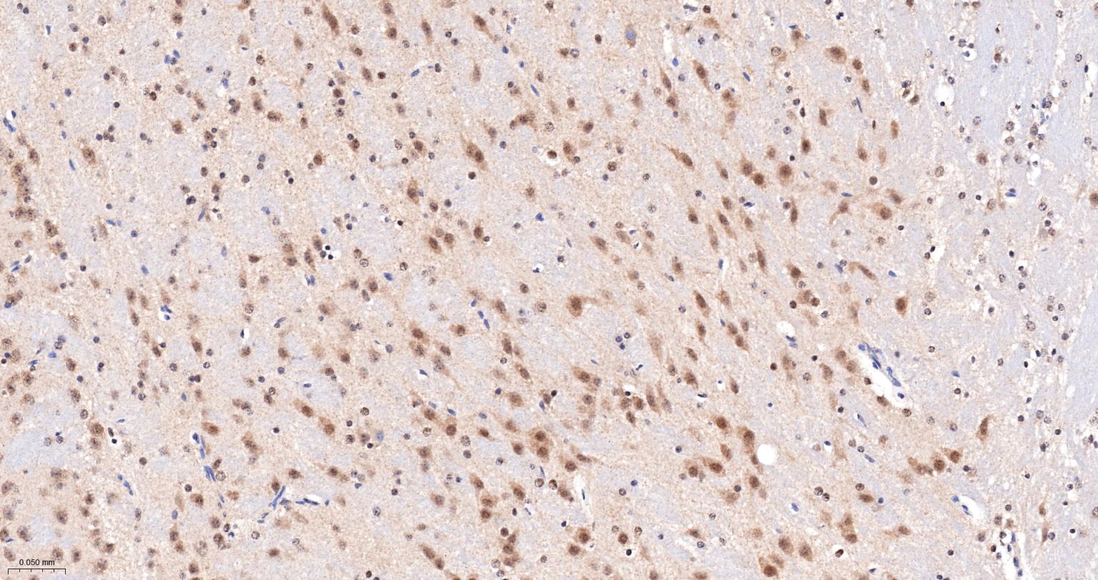 丝/苏氨酸蛋白质激酶II α重组兔单抗