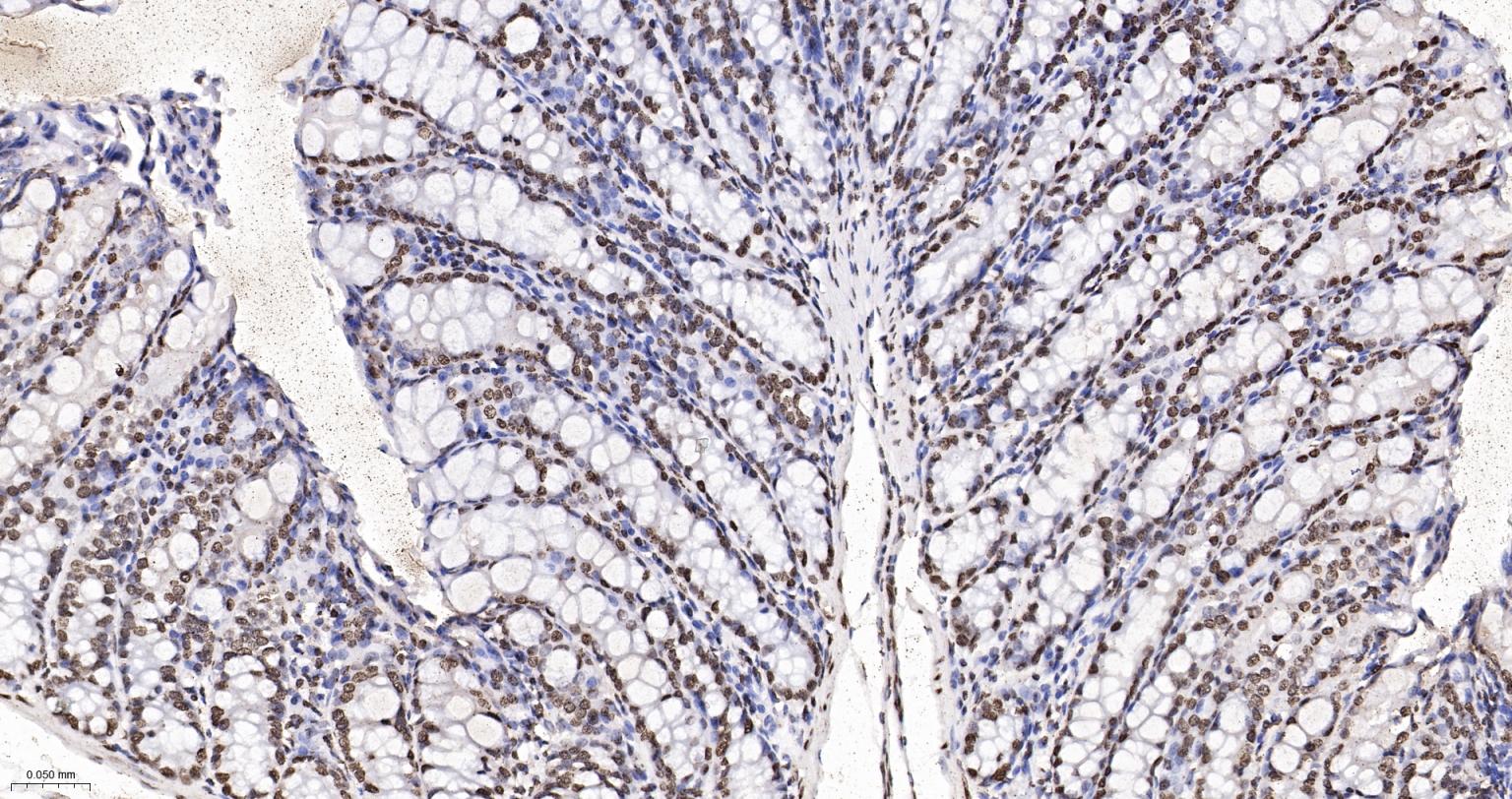 组蛋白H4重组兔单抗