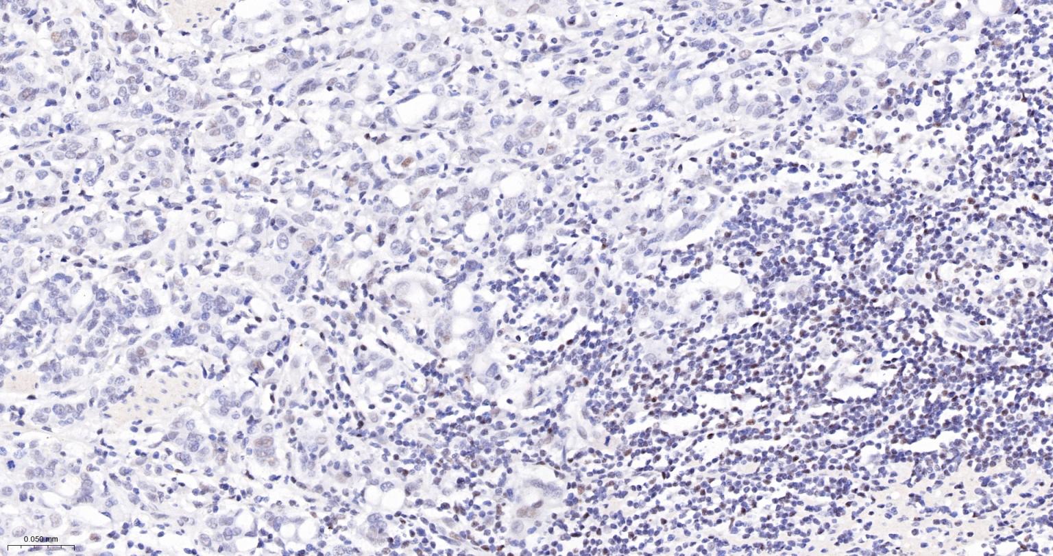 Fas相关死亡结构域蛋白重组兔单抗