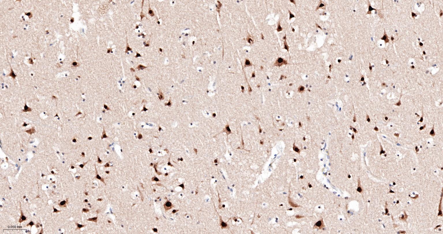 丝/苏氨酸蛋白质激酶II α重组兔单抗
