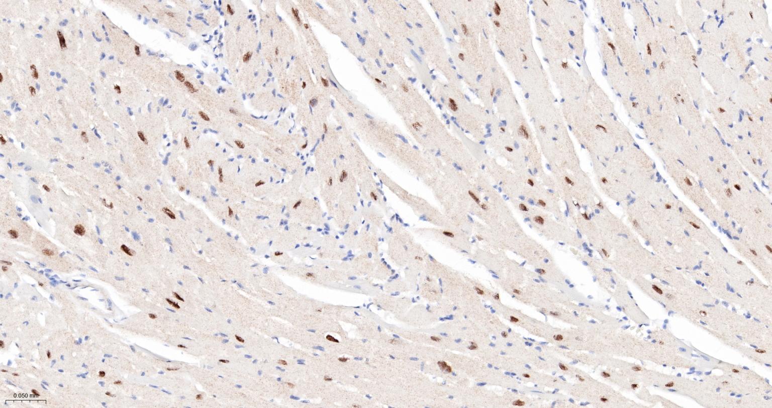 丝/苏氨酸蛋白质激酶II α重组兔单抗