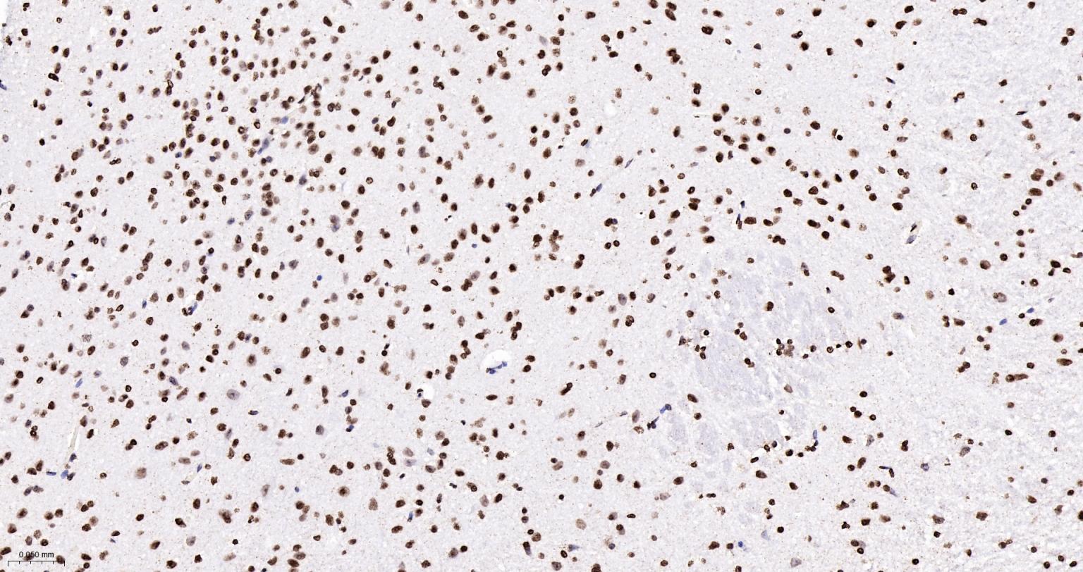 组蛋白H4重组兔单抗