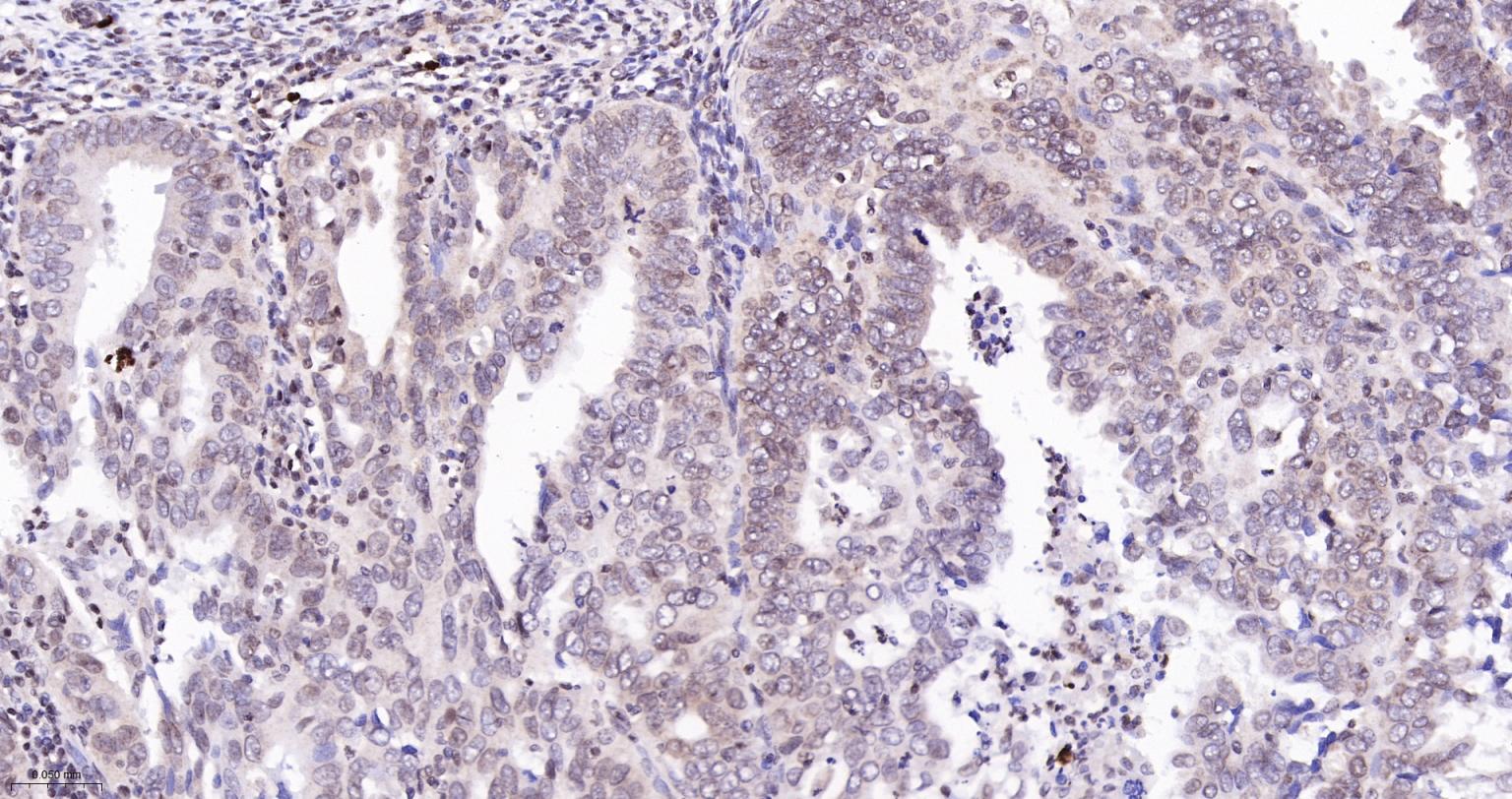 双链RNA腺苷酸脱氨基酶重组兔单抗