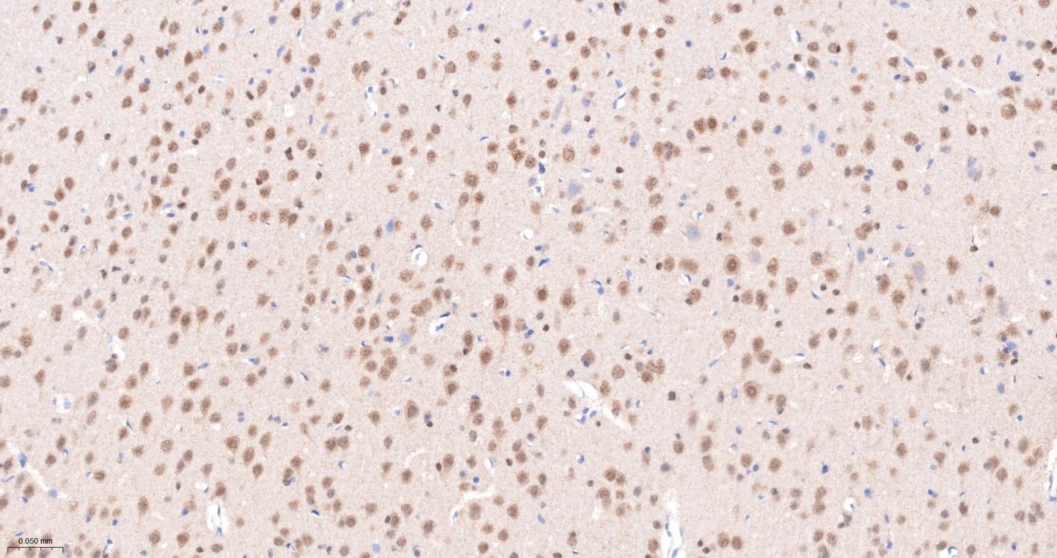 丝/苏氨酸蛋白质激酶II α重组兔单抗