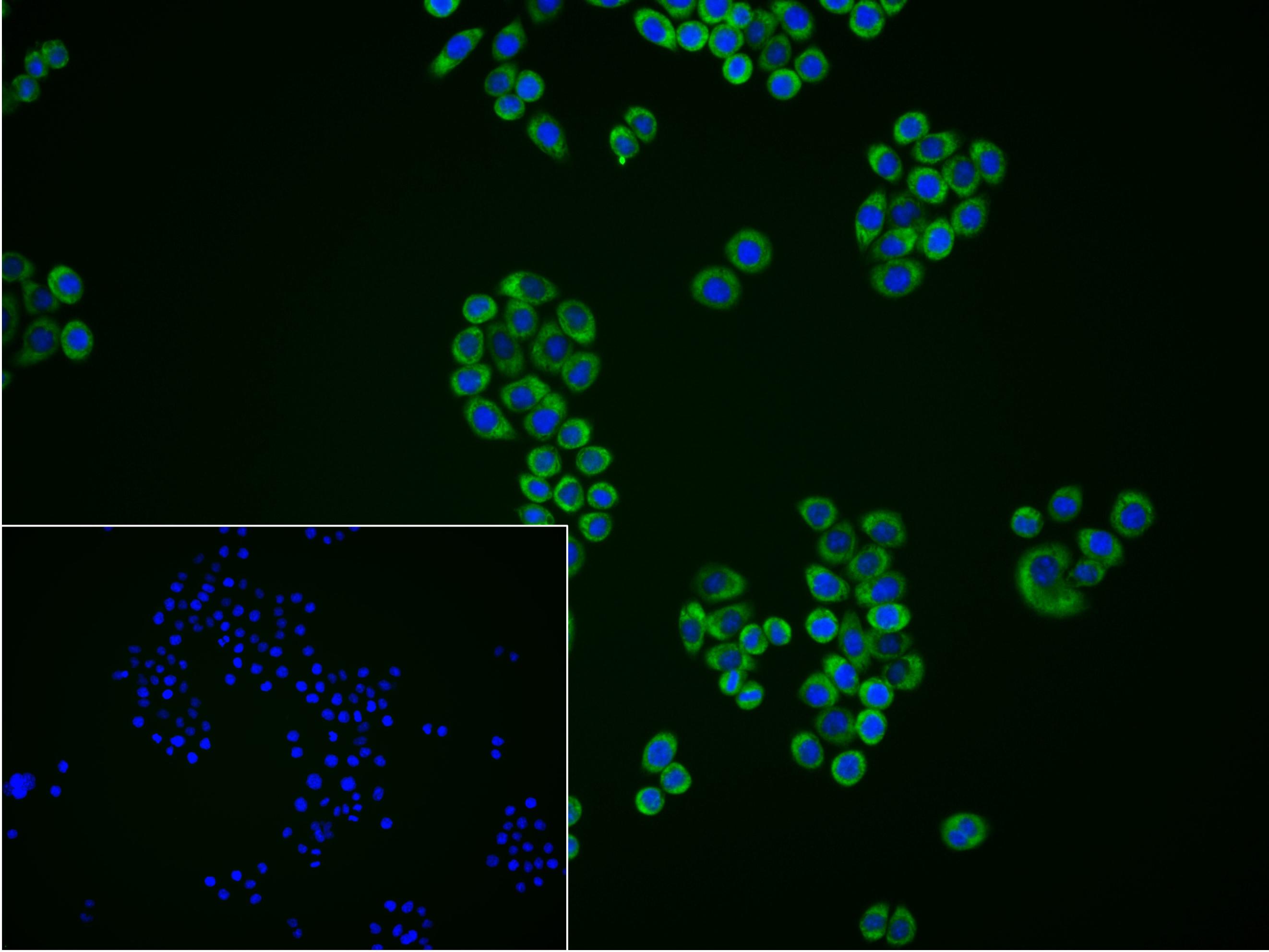 Ras GTP酶活化蛋白结合蛋白1重组兔单抗
