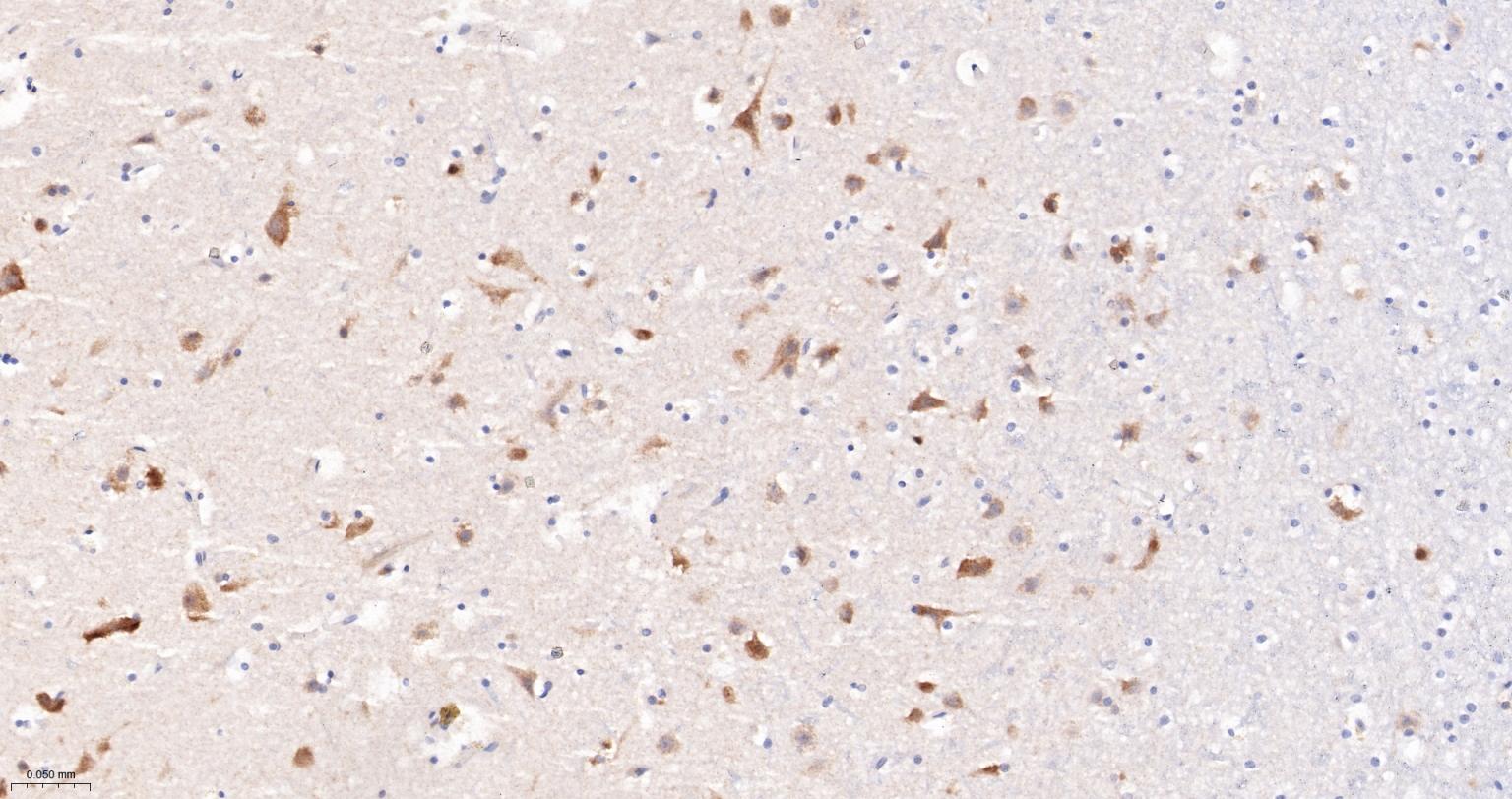 Jun激活区域-连接蛋白1重组兔单抗