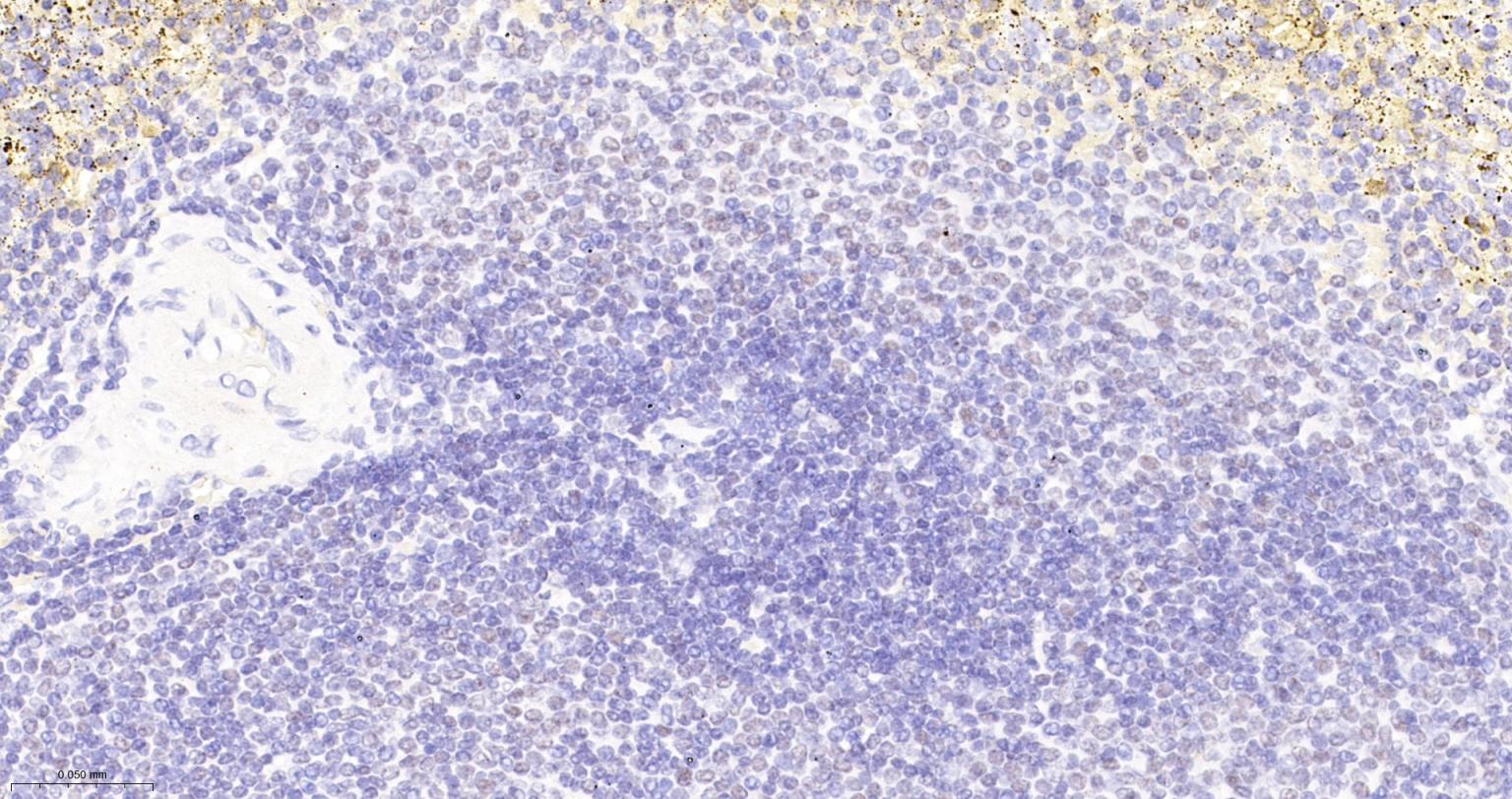 Fas相关死亡结构域蛋白重组兔单抗