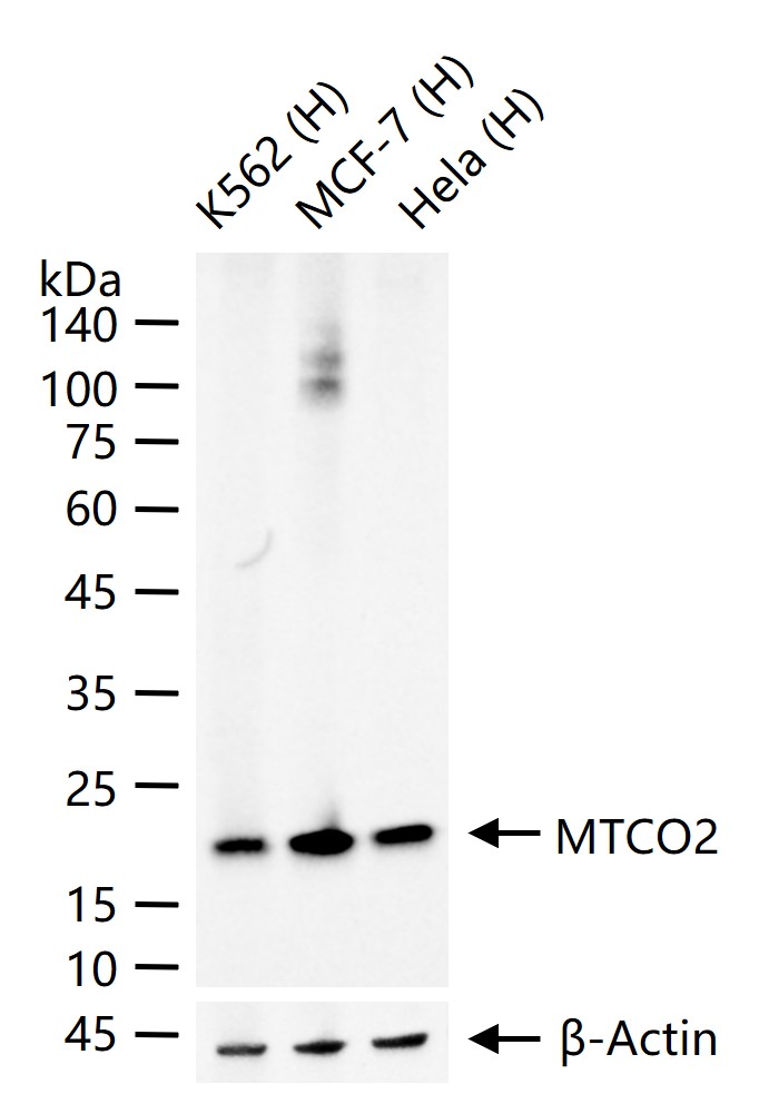 MTCO2 Recombinant Rabbit mAb (一抗) - WB,IHC-P,IHC-F,IF,Flow-Cyt | Bioss