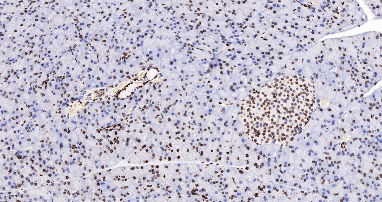 组蛋白H4重组兔单抗