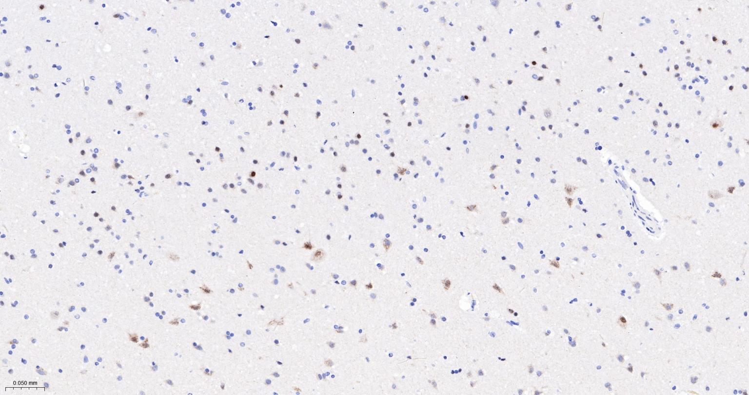 Caspase-6重组兔单抗