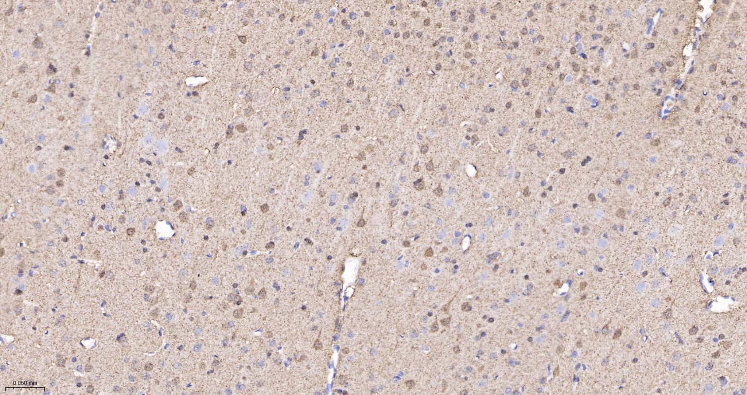 白血病相关蛋白18/癌蛋白18重组兔单抗