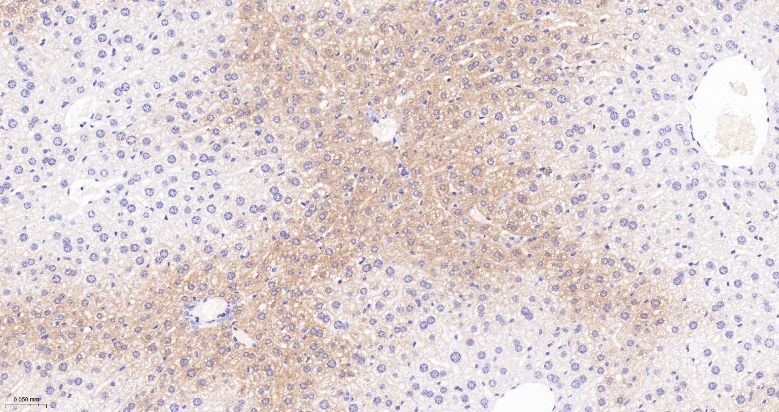 Jun激活区域-连接蛋白1重组兔单抗