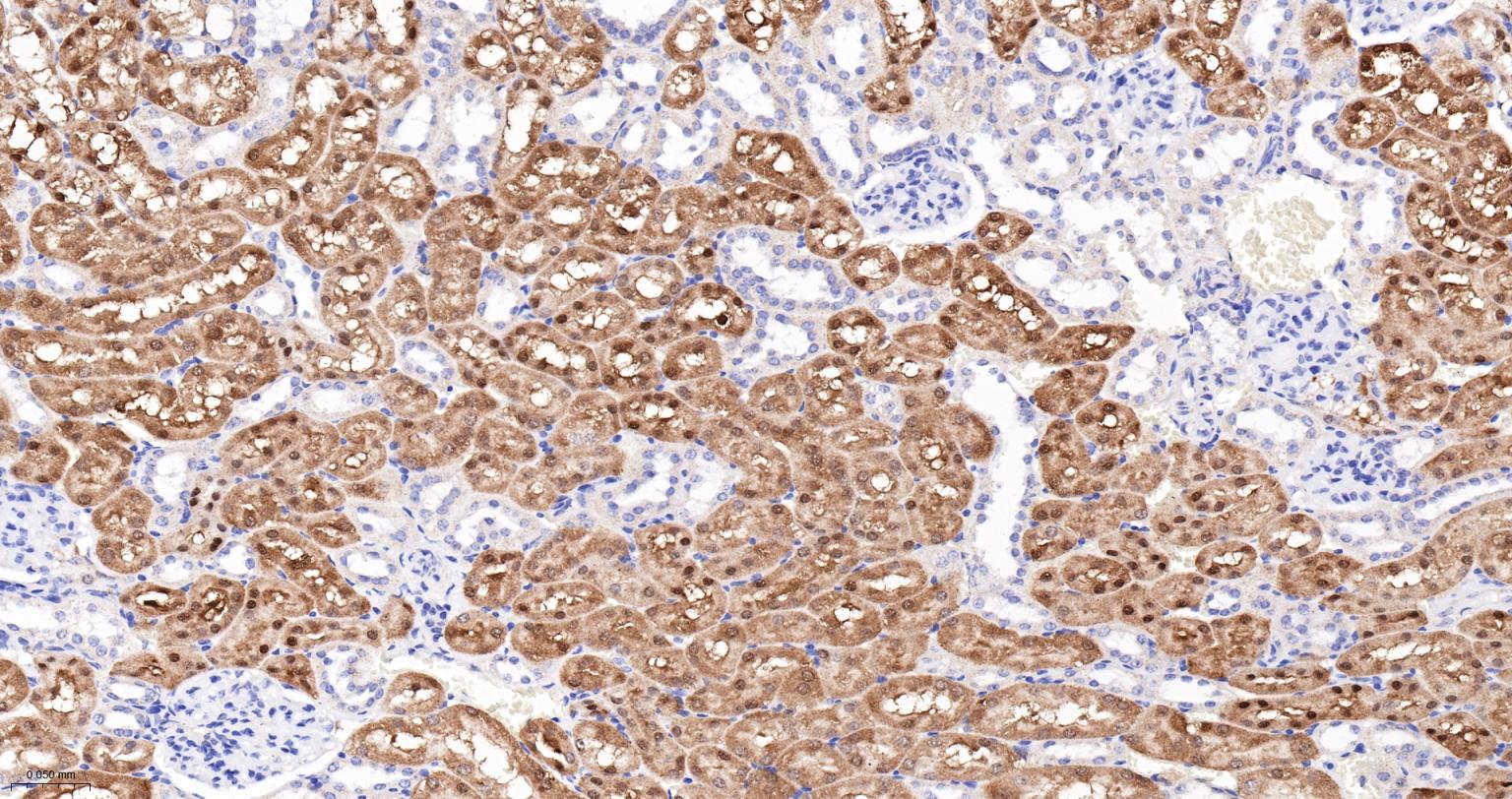 ALKBH1蛋白重组兔单抗