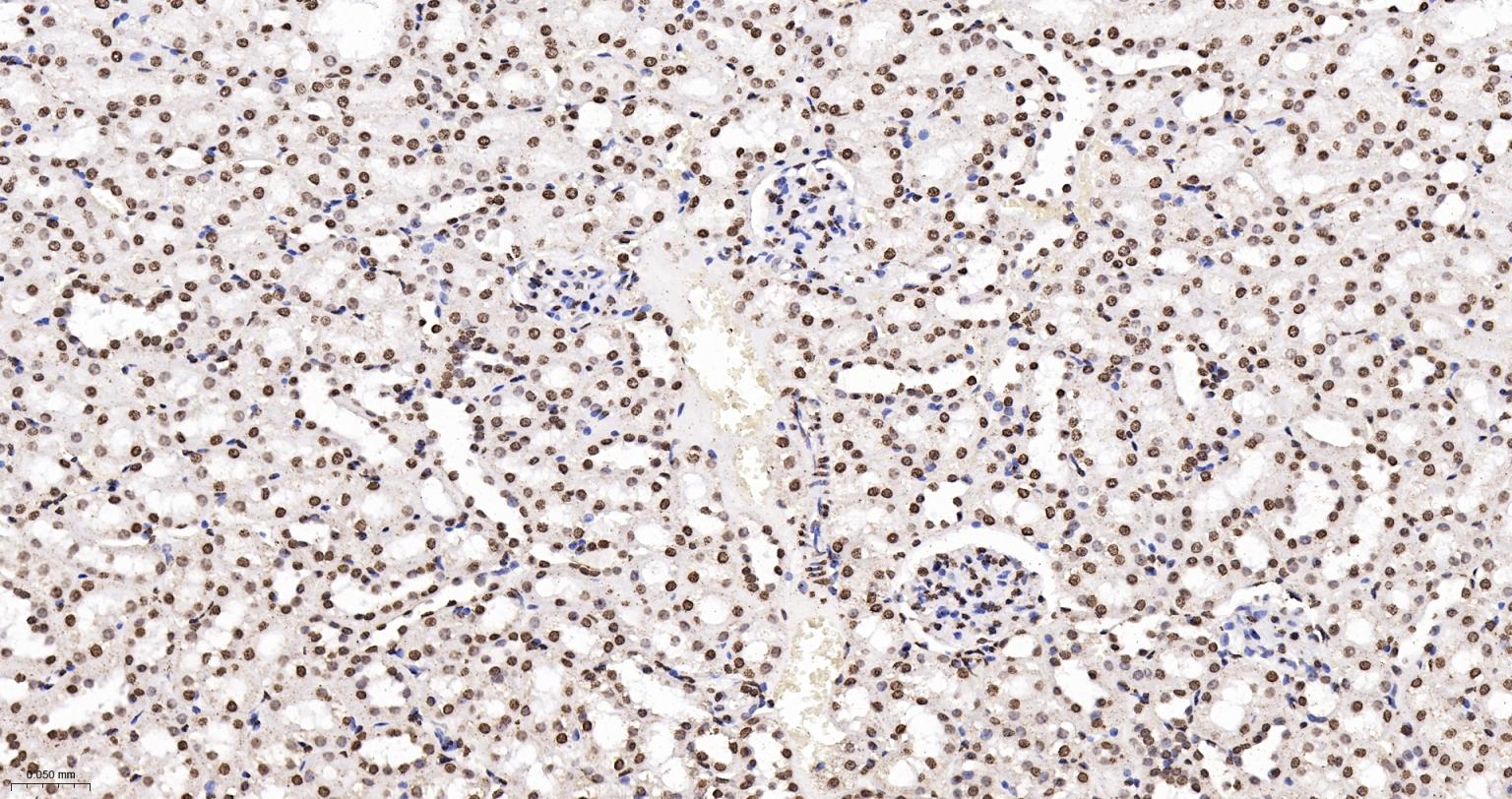 组蛋白H4重组兔单抗