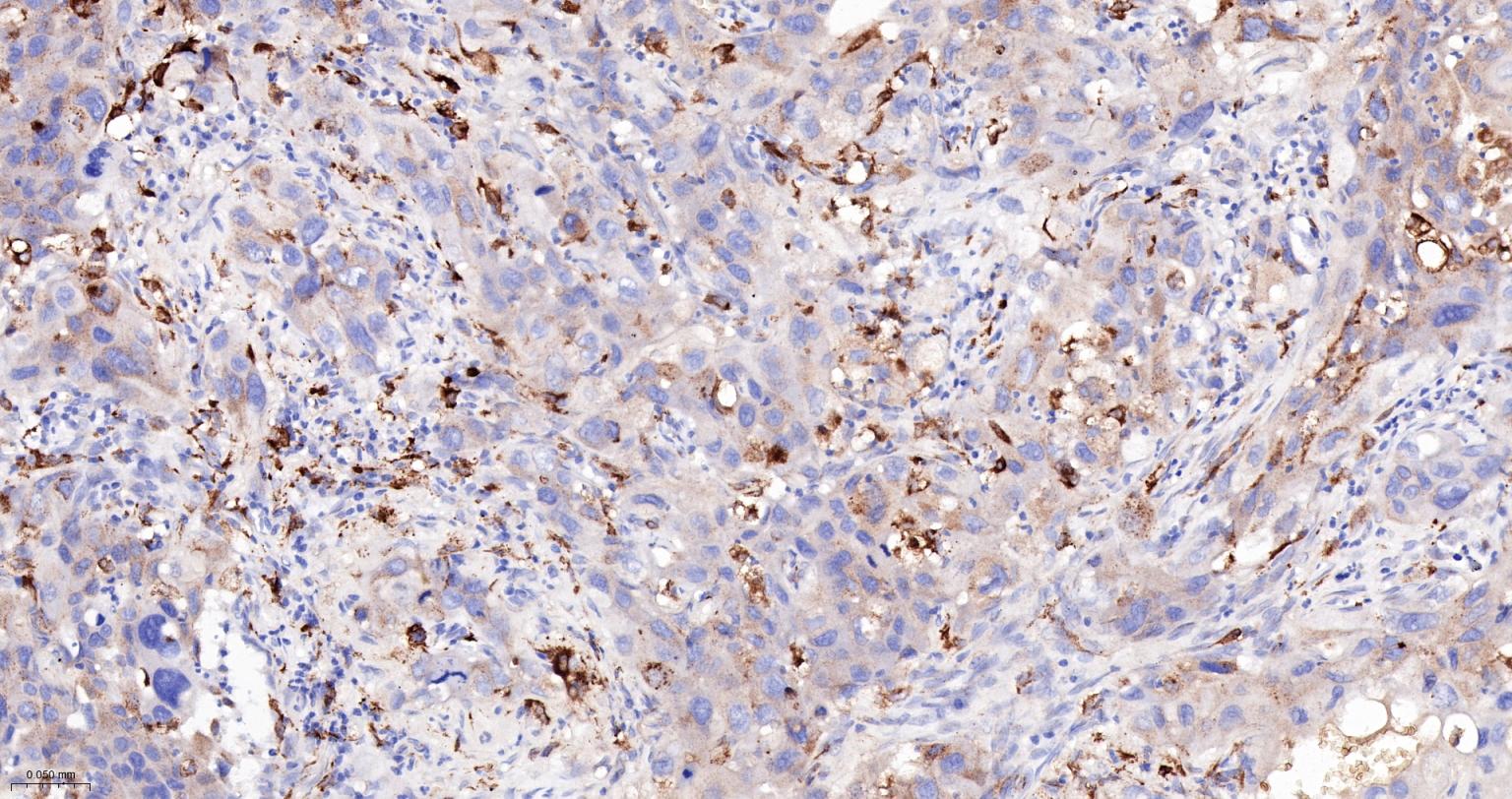 组织蛋白酶B重组兔单抗