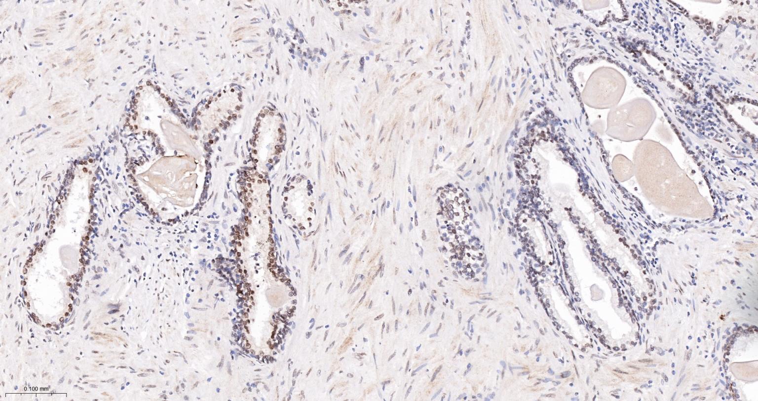 双链RNA腺苷酸脱氨基酶重组兔单抗