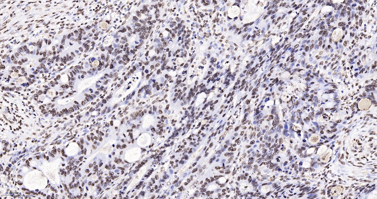 组蛋白H4重组兔单抗