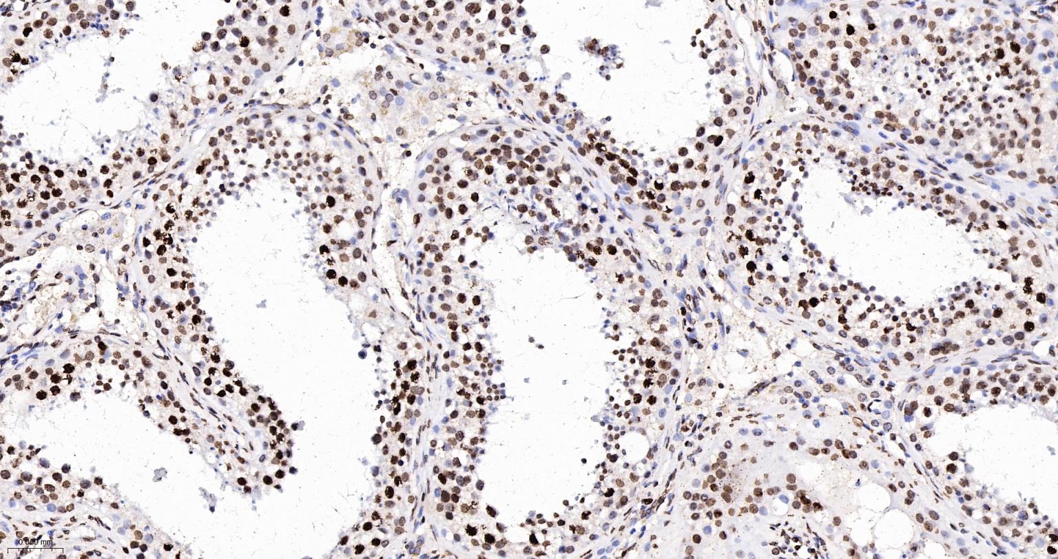 组蛋白H4重组兔单抗