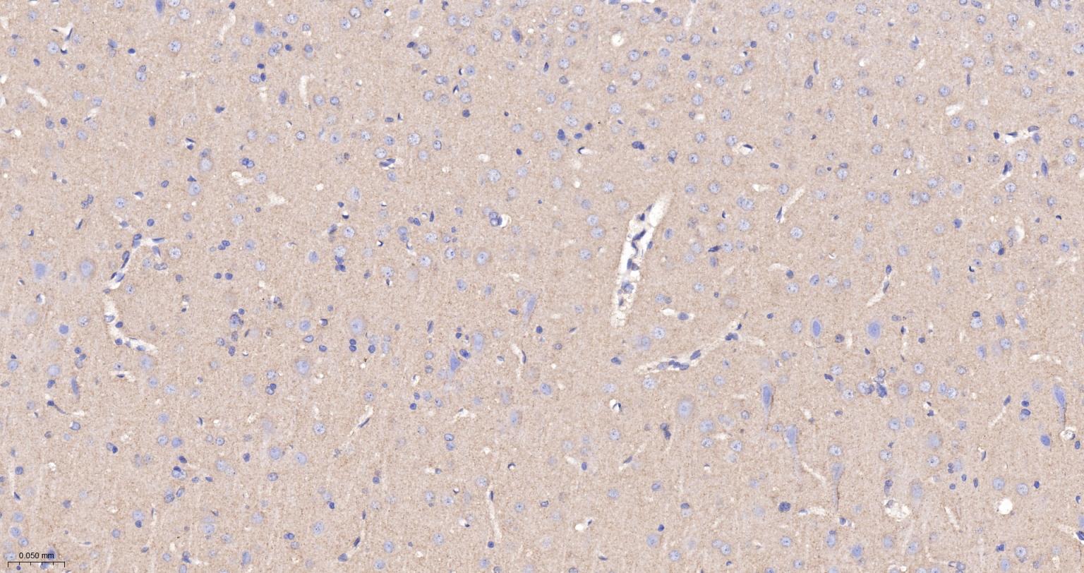 皮层肌动蛋白重组兔单抗