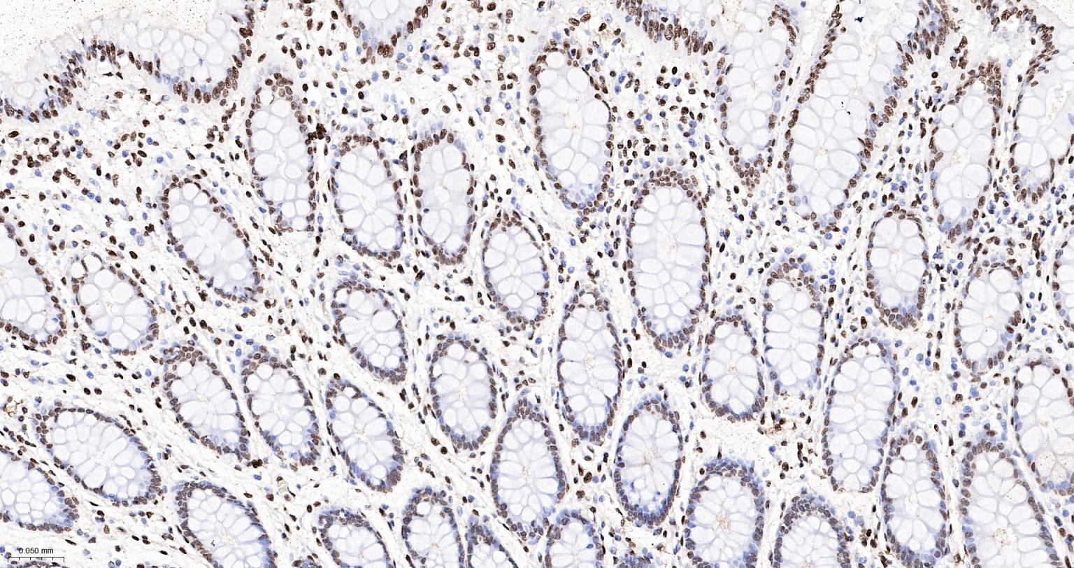 组蛋白H4重组兔单抗