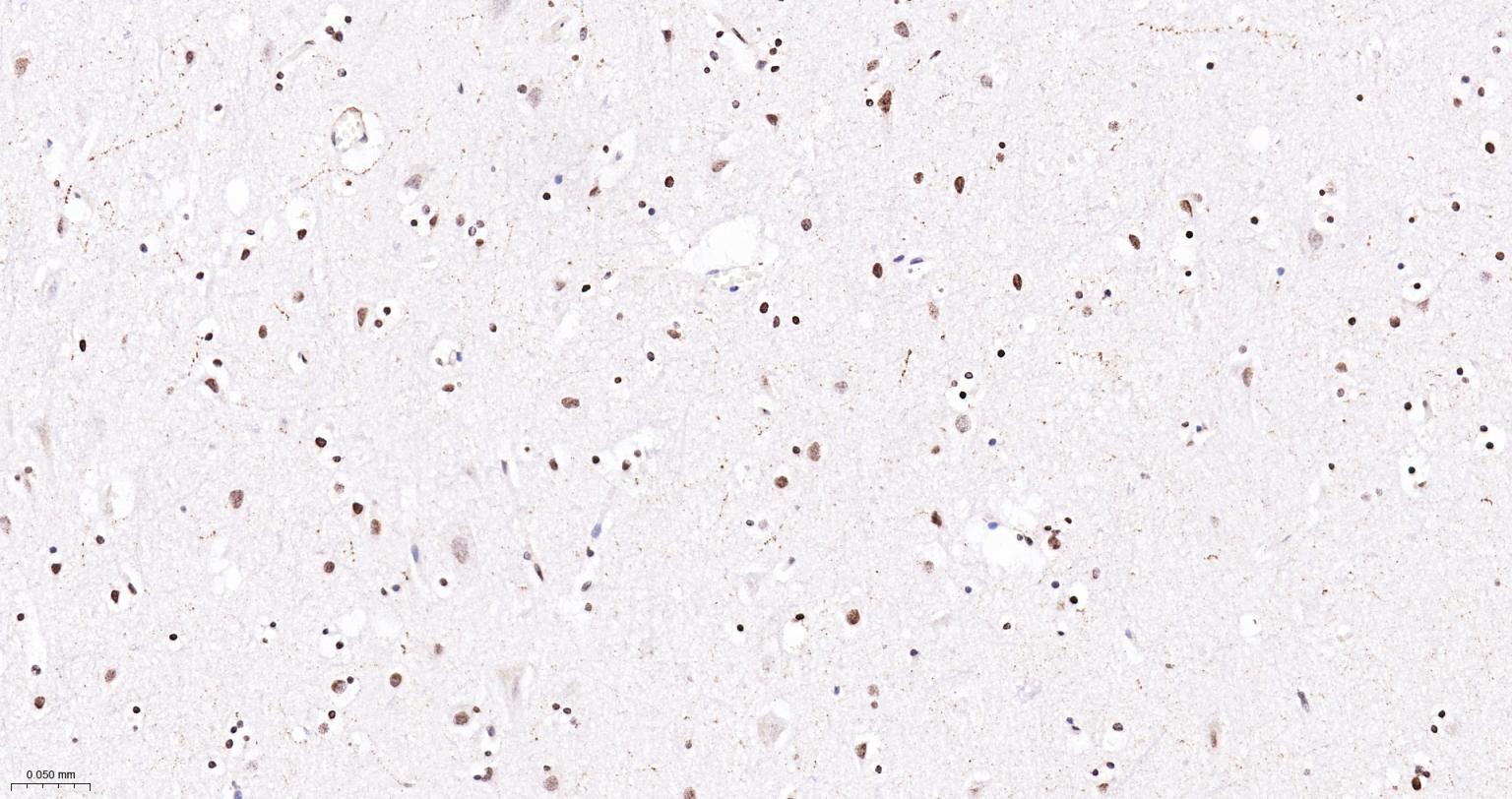 双链RNA腺苷酸脱氨基酶重组兔单抗