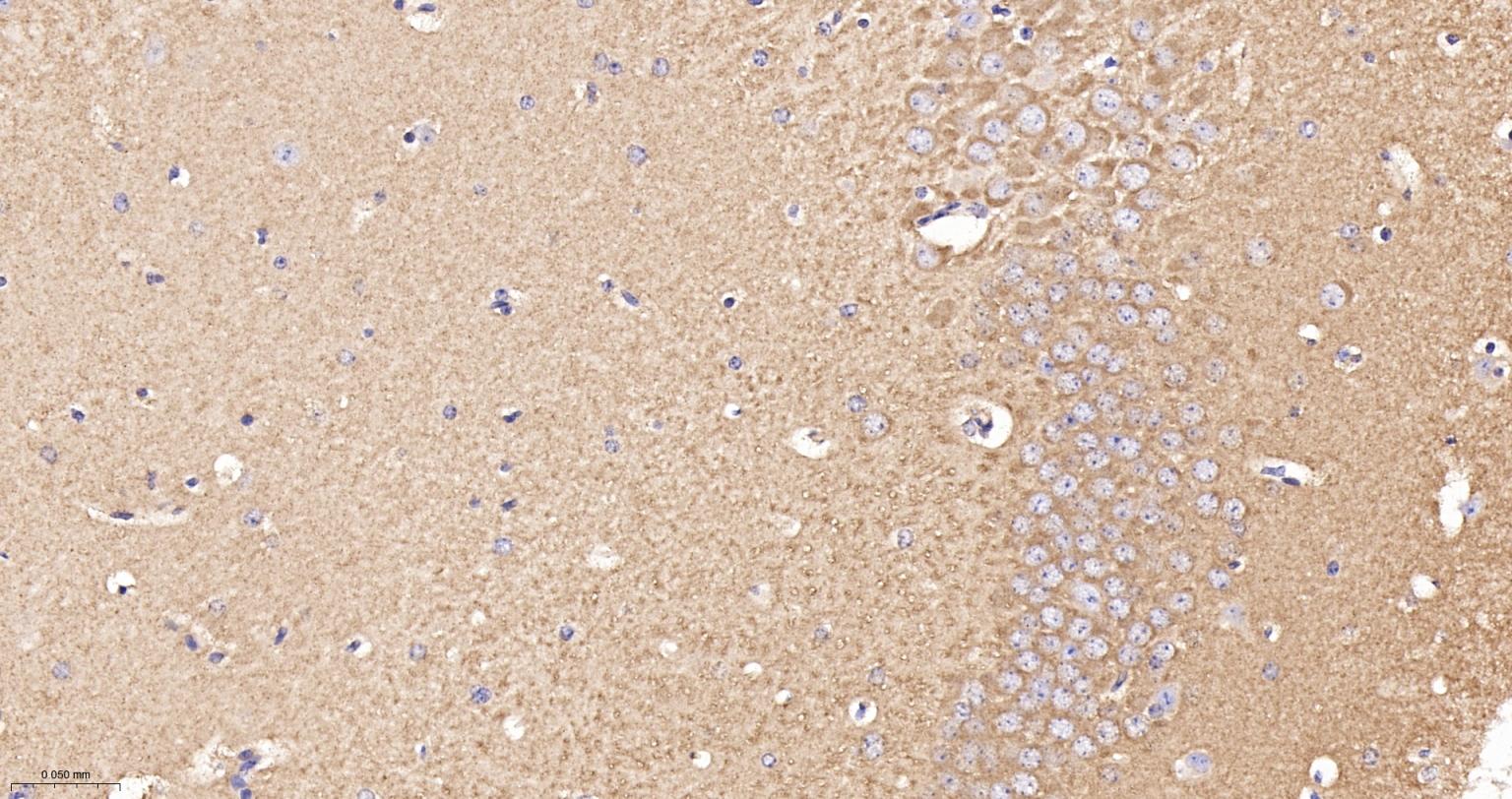 皮层肌动蛋白重组兔单抗