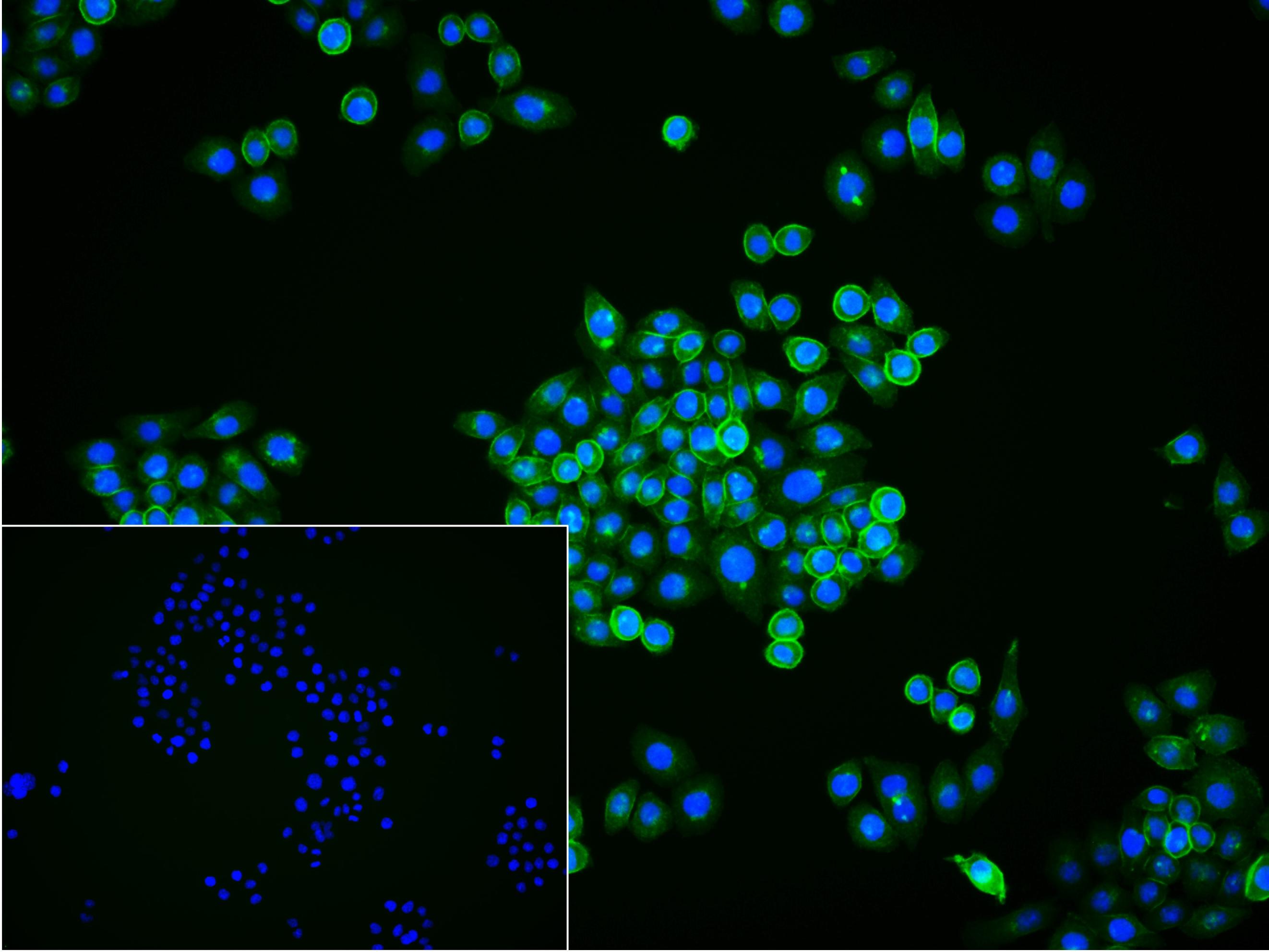 表皮生长因子受体重组兔单抗