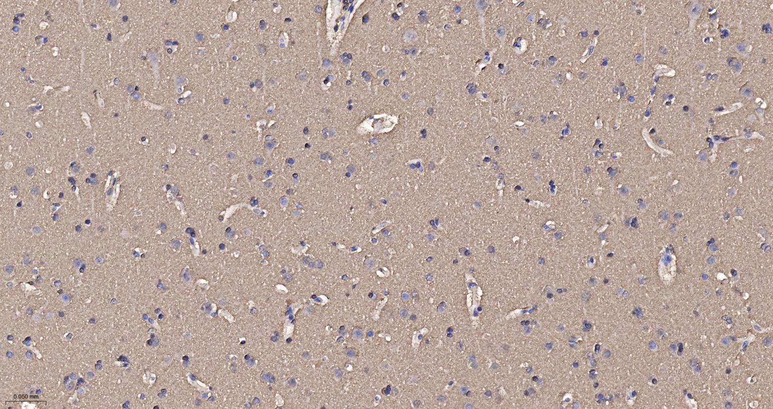 核突触蛋白-α重组兔单抗