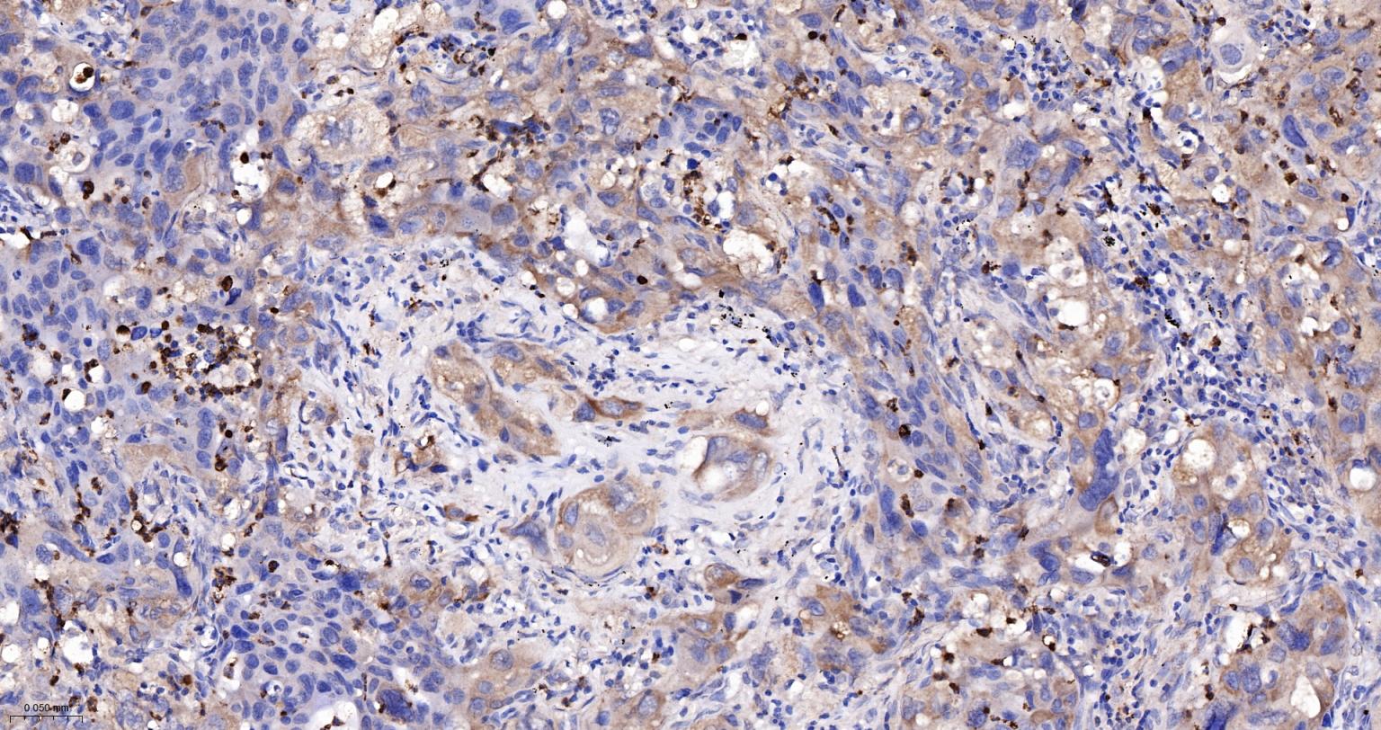Ras GTP酶活化蛋白结合蛋白1重组兔单抗