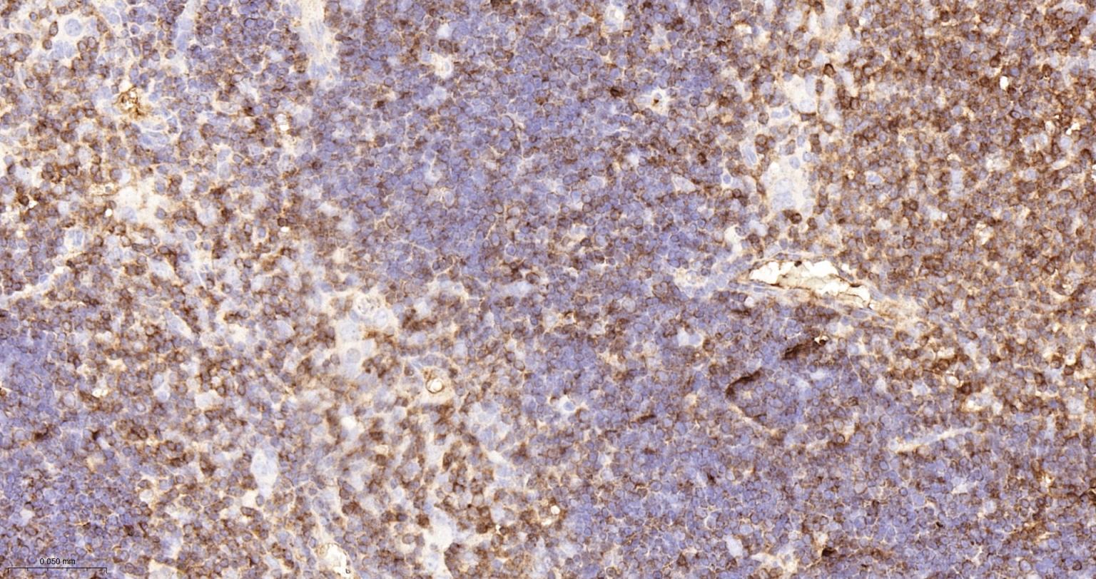 CD3/CD3-ε重组兔单抗