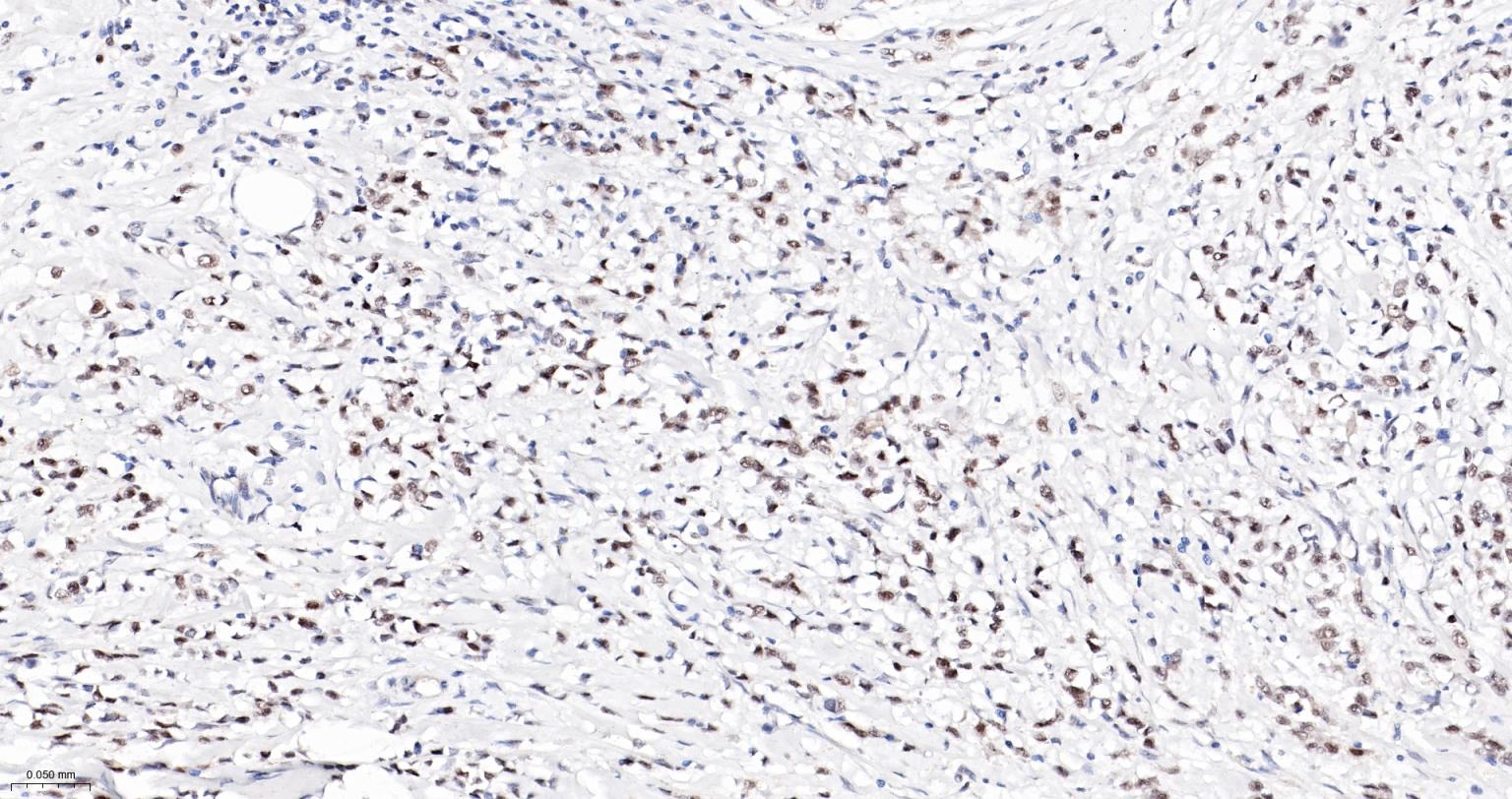 丝/苏氨酸蛋白质激酶II α重组兔单抗