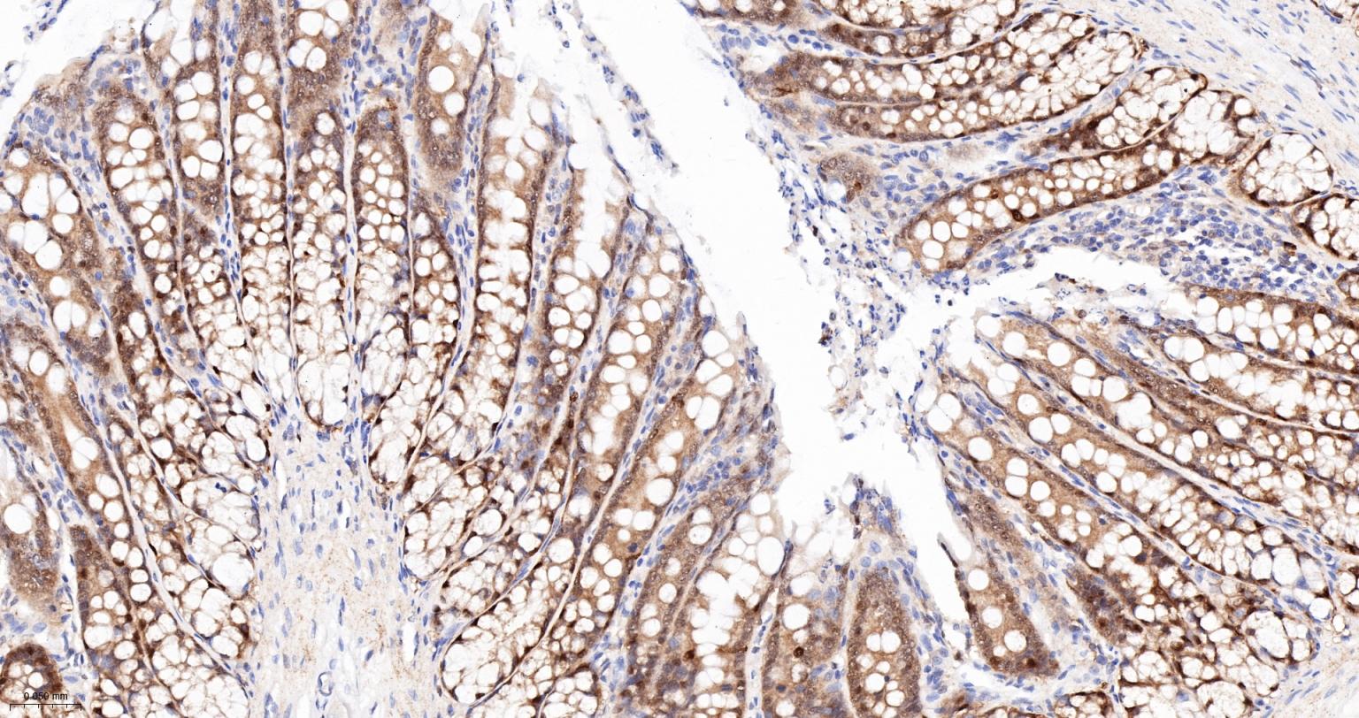 Caspase-6重组兔单抗