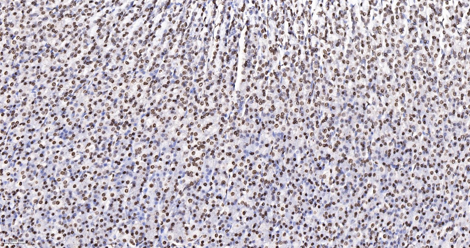 组蛋白H4重组兔单抗