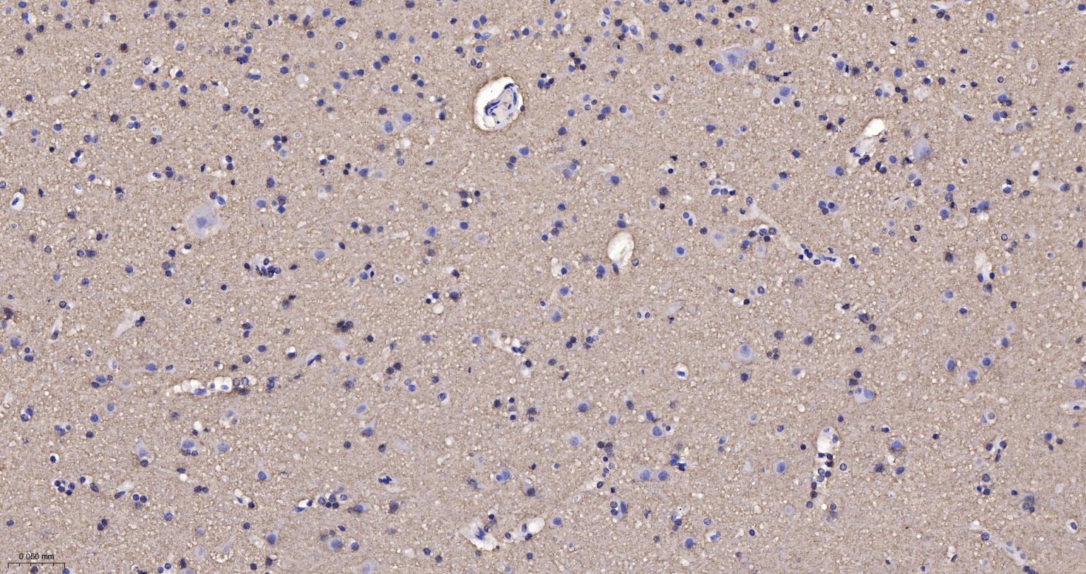 核突触蛋白-α重组兔单抗
