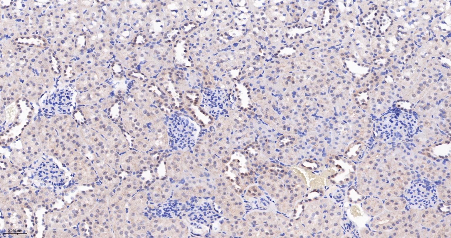 Jun激活区域-连接蛋白1重组兔单抗
