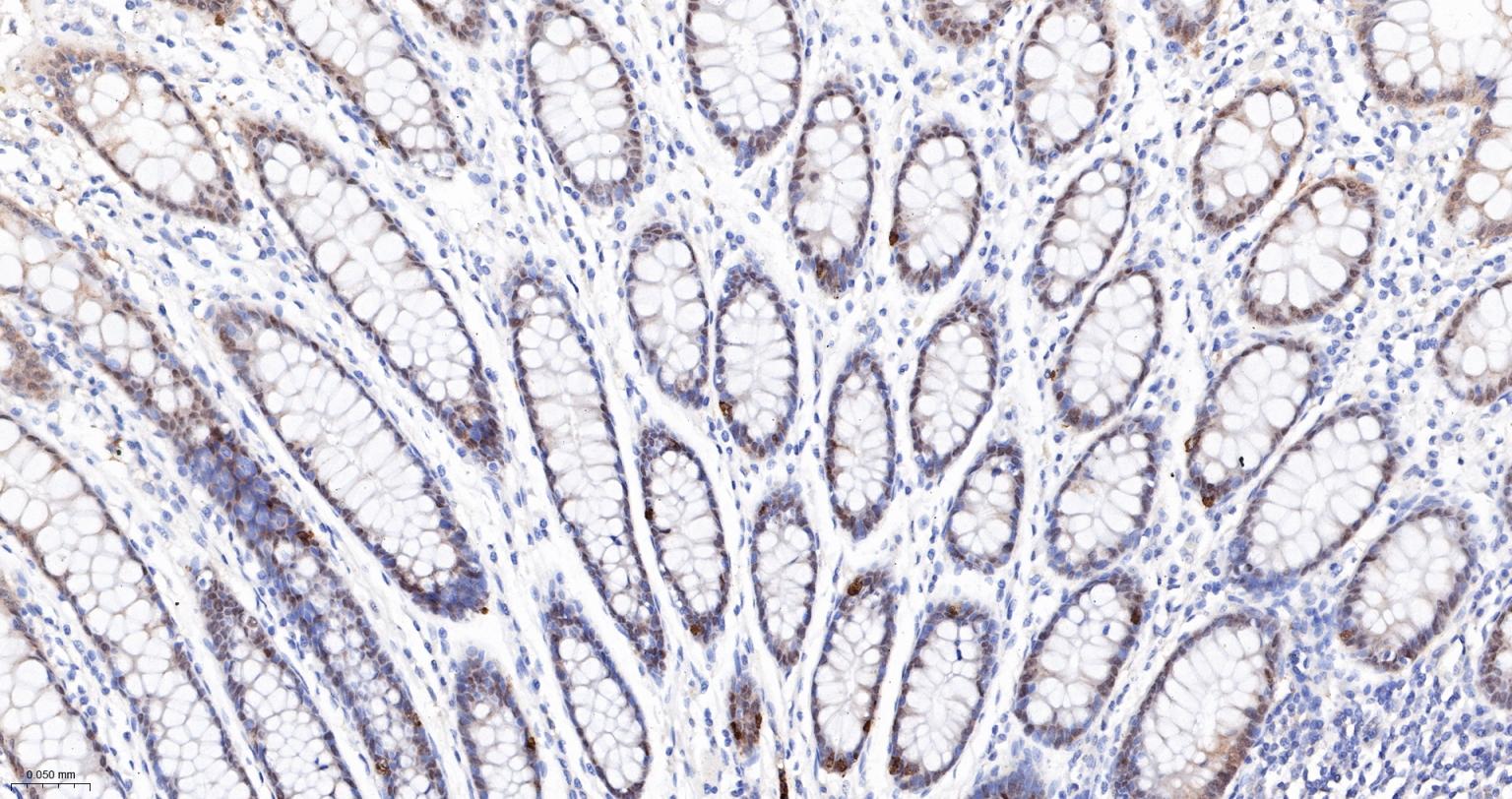 Caspase-6重组兔单抗