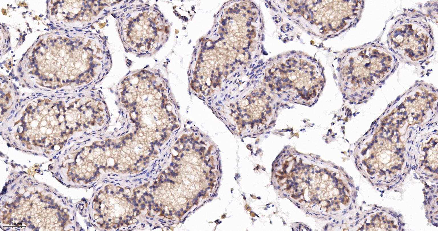 皮层肌动蛋白重组兔单抗