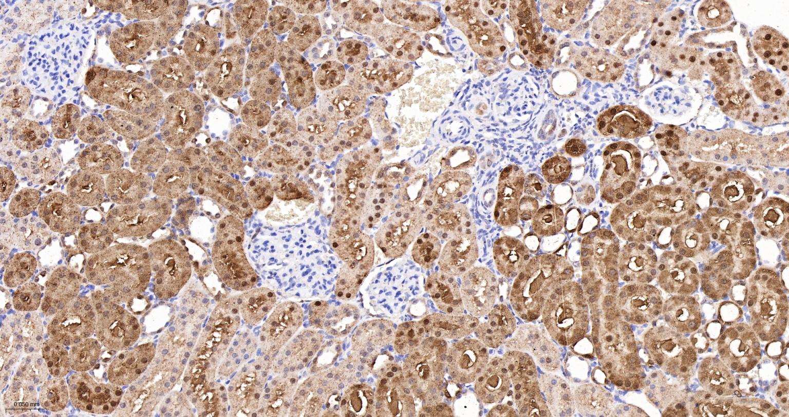 ALKBH1蛋白重组兔单抗