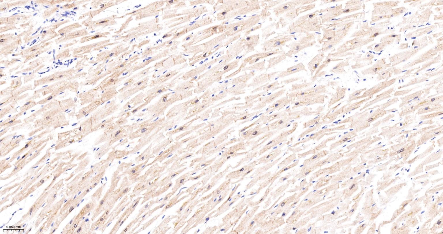 钙/钙调素依赖蛋白激酶2D(CaMKIIδ)重组兔单抗-bsm-61477R