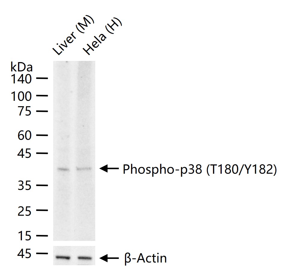 磷酸化p38 MAPK重组兔单抗