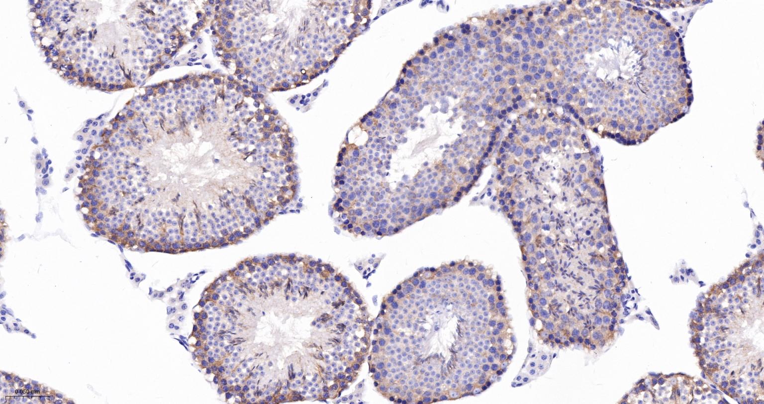 皮层肌动蛋白重组兔单抗