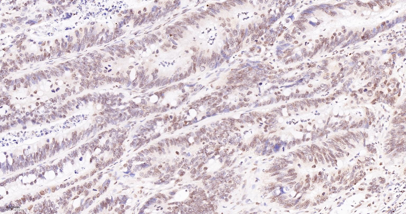 双链RNA腺苷酸脱氨基酶重组兔单抗