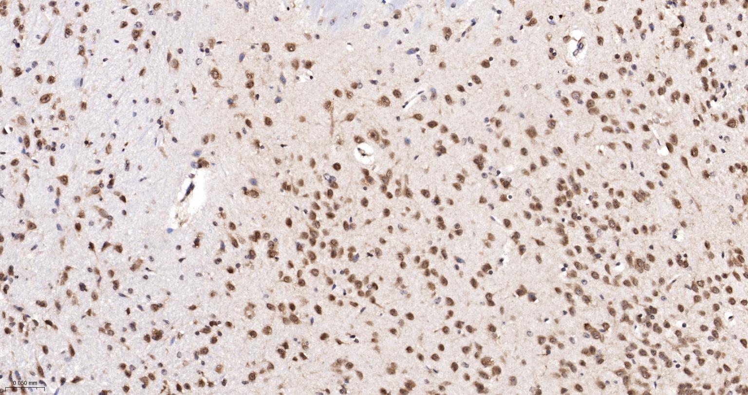 泛素蛋白连接酶E2I重组兔单抗