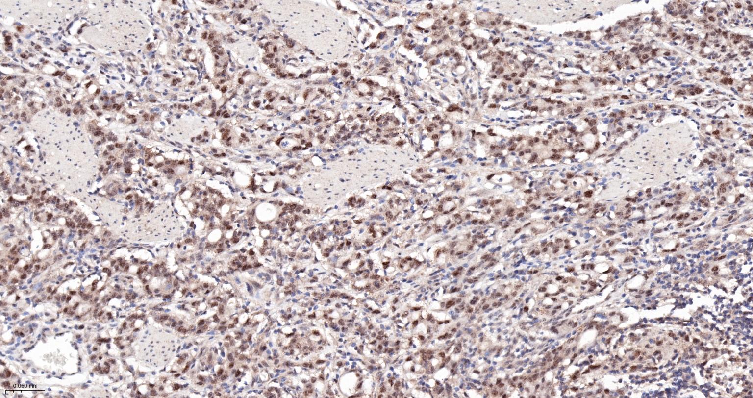 丝/苏氨酸蛋白质激酶II α重组兔单抗