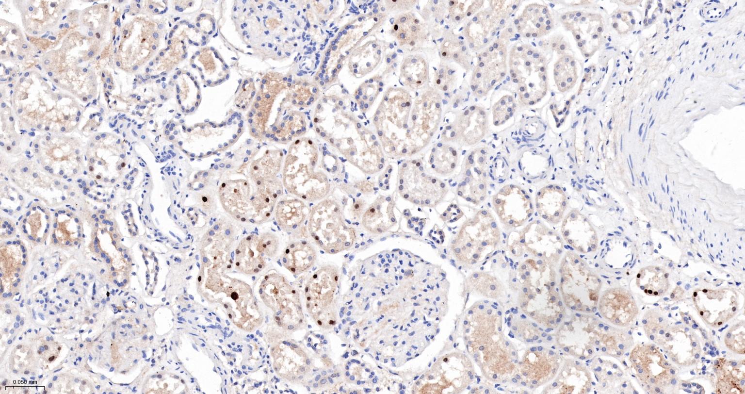 ALKBH1蛋白重组兔单抗